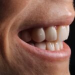 dentition saine