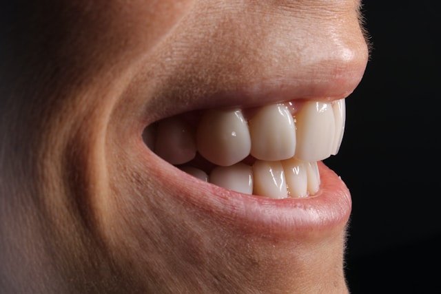 dentition saine